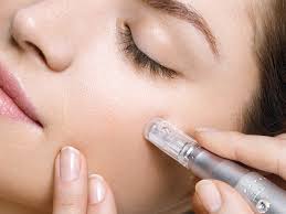 Microneedling incl. Collageen led therapy 