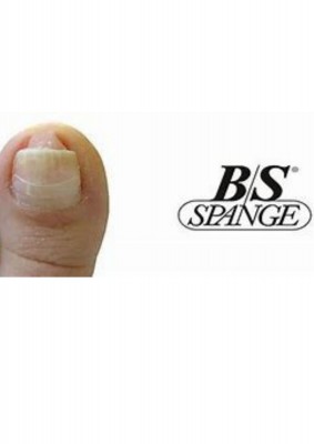 medische pedicure  inclusief 1 nagelbeugel BS SPANGE (1 nagel)