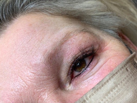PMU eyeliner bijwerking onder na 1-3 jaar
